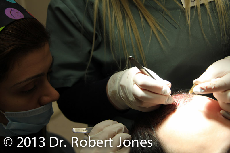 Hairline Treatment & Services Hairline Treatment & Services