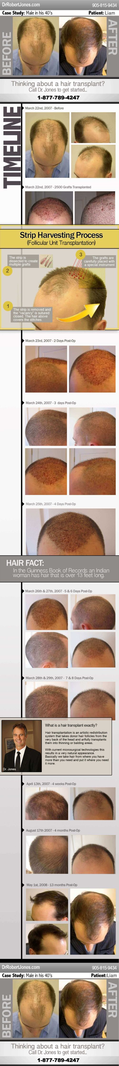 infographic-Liam-img-2