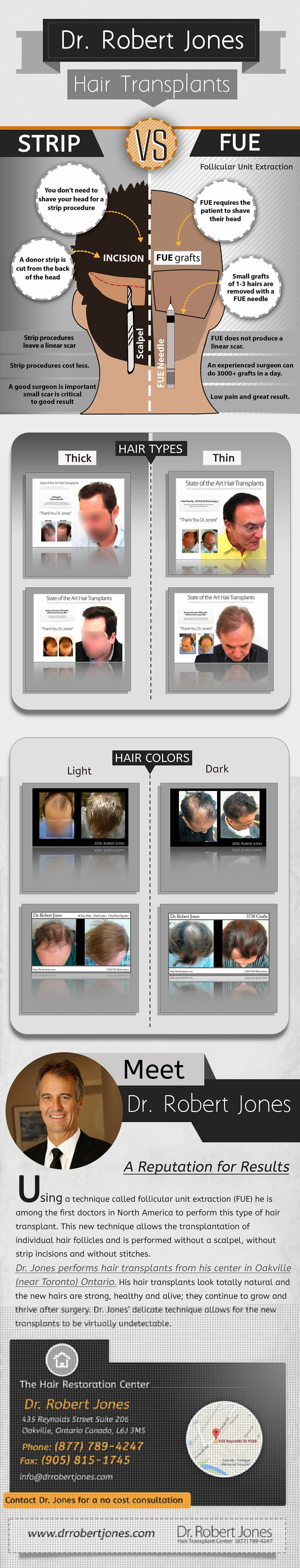 2014-8-21-960-tall-fue-vs-strip-infographic-imgs-1