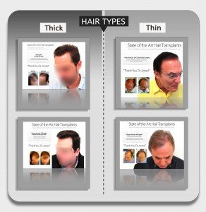 Hair Transplant Types