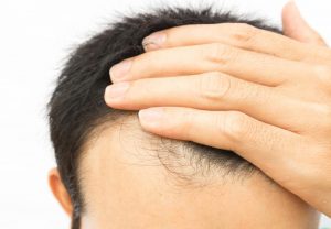 Biotin 01 Hair Loss Supplement Benefits
