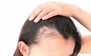 Biotin 2 Hair Growth Vitamin Effects