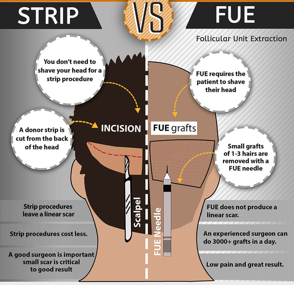 2014-8-21-960square-strip-fue-tall-fue-vs-strip-infographic