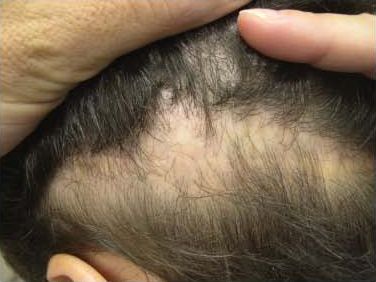 dermatologic-surgery-1