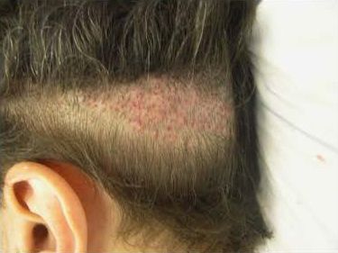 dermatologic-surgery-2-1