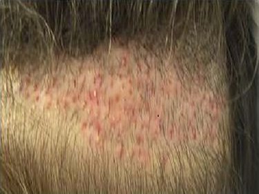 dermatologic-surgery-3