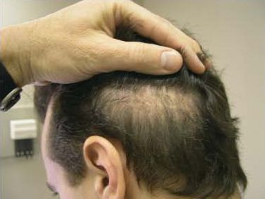 dermatologic-surgery-4