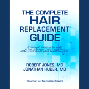 The Complete Hair Replacement Guide