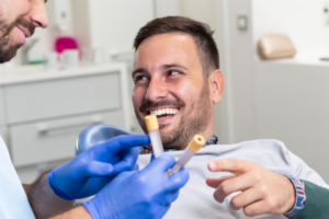 Hair Loss in 20s and 30s - PRP