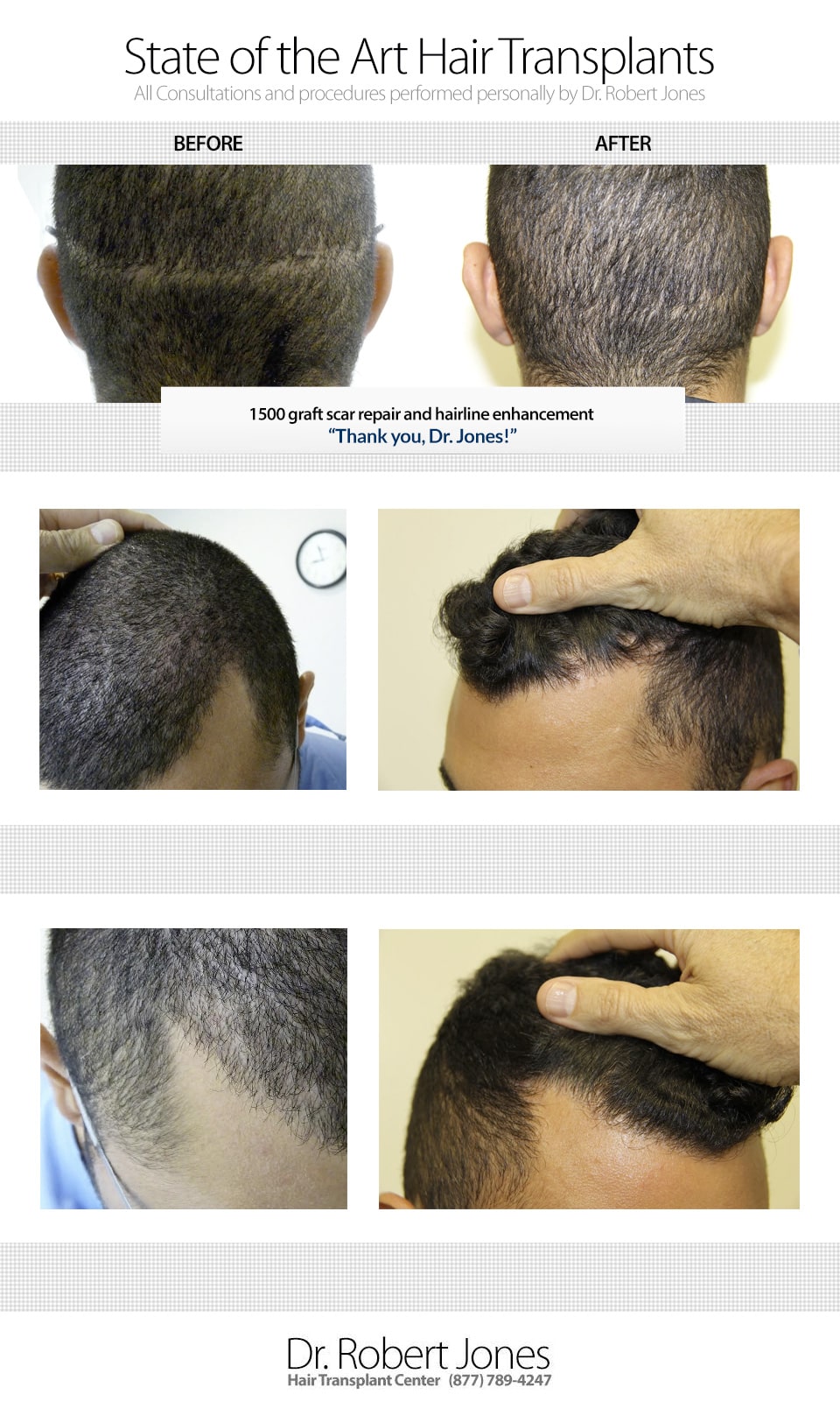 State of the Art Hair Transplants State of the Art Hair Transplants