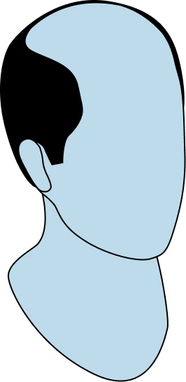 hair-loss-significant-factors