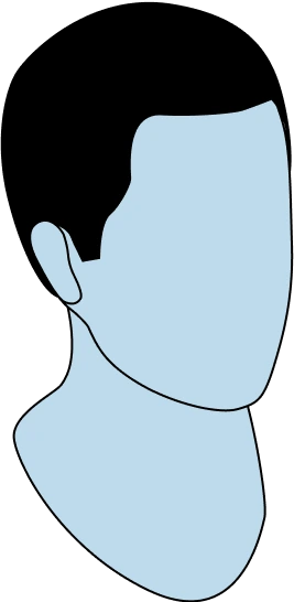 hair-restoration-treatment