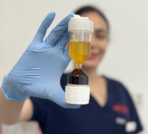 platelet-rich-plasma-separated-platelets